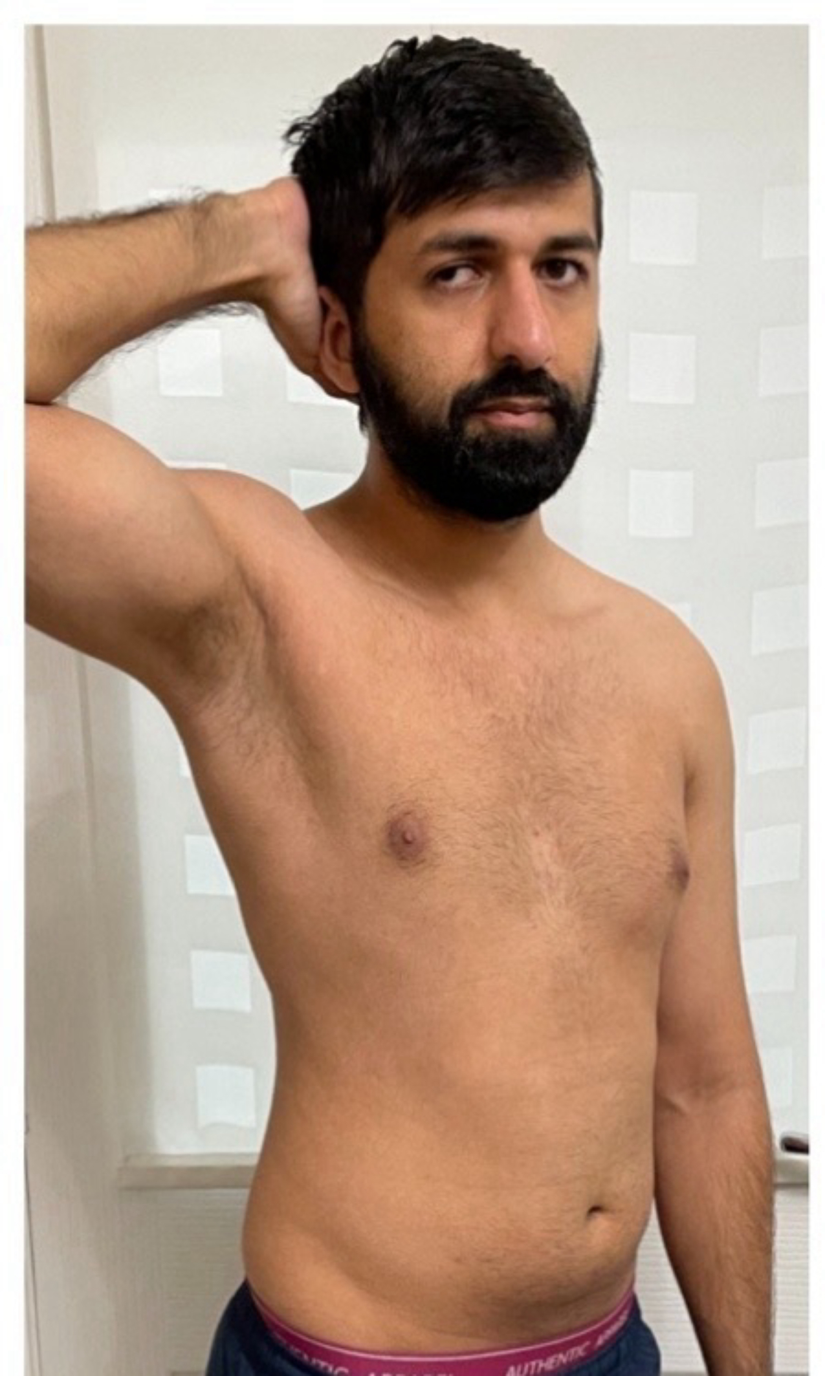 Aman before